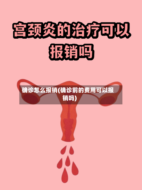 确诊怎么报销(确诊前的费用可以报销吗)-第2张图片