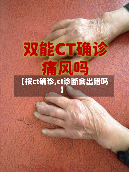 【按ct确诊,ct诊断会出错吗】