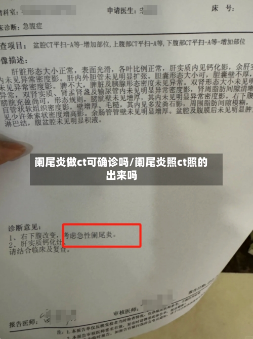 阑尾炎做ct可确诊吗/阑尾炎照ct照的出来吗-第3张图片