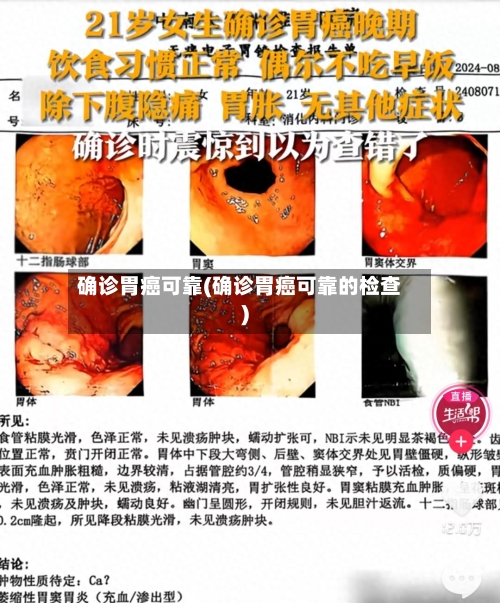 确诊胃癌可靠(确诊胃癌可靠的检查)