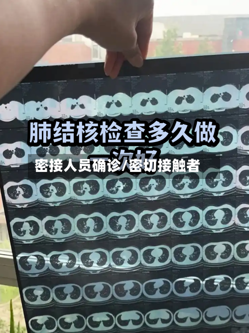 密接人员确诊/密切接触者-第2张图片