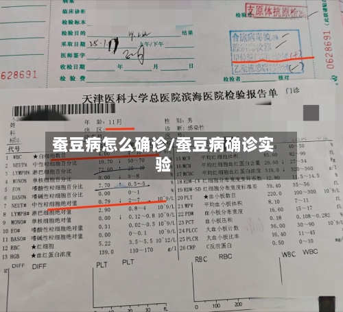 蚕豆病怎么确诊/蚕豆病确诊实验-第2张图片