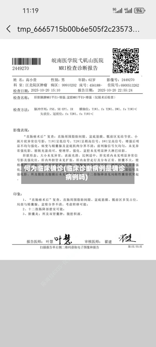 何为临床确诊(临床诊断病例是确诊病例吗)