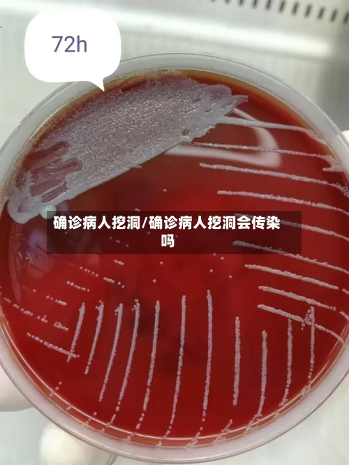 确诊病人挖洞/确诊病人挖洞会传染吗-第2张图片